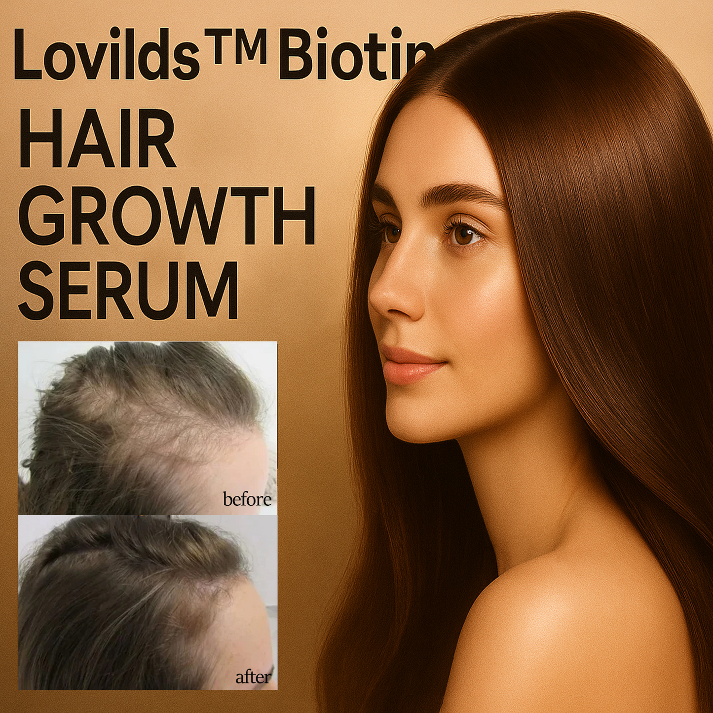 ✅Official Store | Lovilds™ Biotin Premium Hair Growth Serum