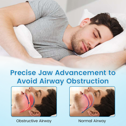 LAST DAY SALE 60% OFF ⏰ PerfectSleep Solution – Snore-Reducing & Teeth-Grinding Guard